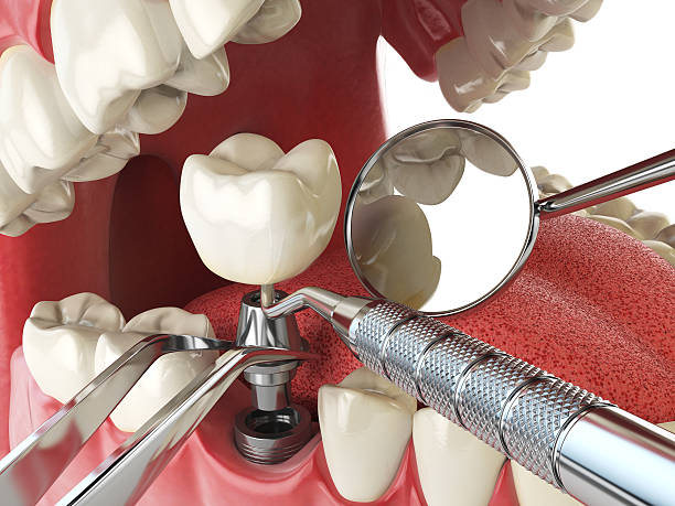 Tooth Infection Emergency Dentist in NJ